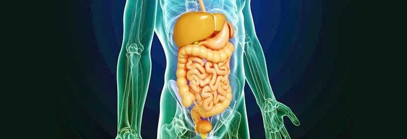 Colorectal cancer