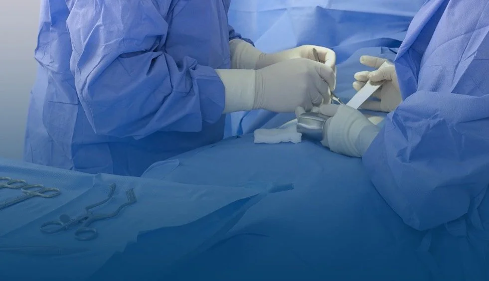Orthocystic fistula, York-Mason method.